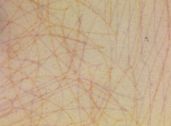 Image 68704 of Substrate
